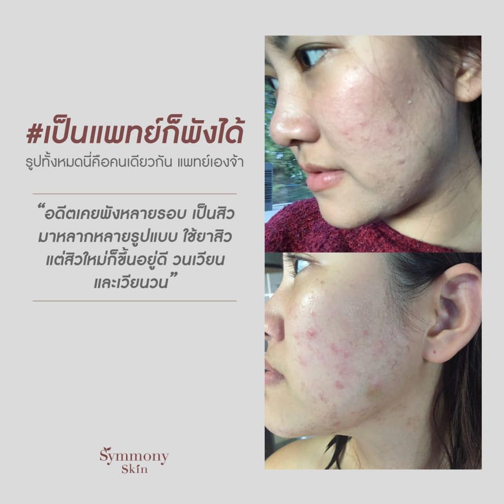 Relief Gentle Essence — เอสเซนส์ฟื้นฟูผิวจาก Symmony Skin